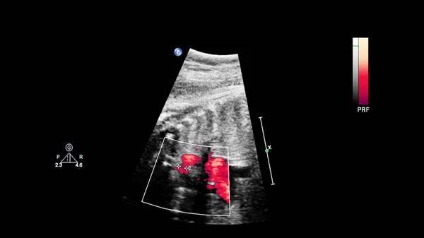 Echografie scherm met foetale echocardiografie. — Stockfoto