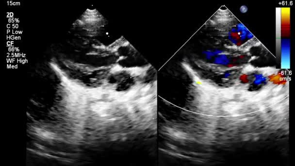 心臓像を持つ超音波機械のスクリーン — ストック動画