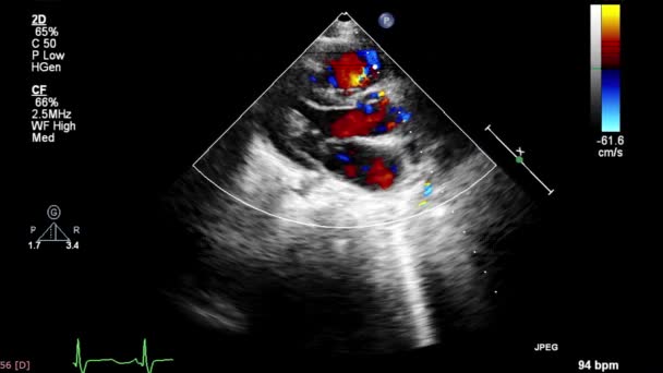 Tela Uma Máquina Ultrassom Com Uma Imagem Coração — Vídeo de Stock