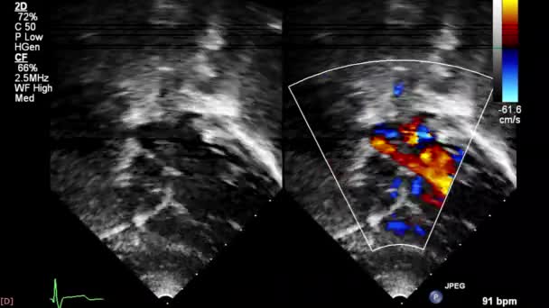 Kalp Görüntüsü Reisi Olan Bir Ultrason Makinesinin Ekranı — Stok video