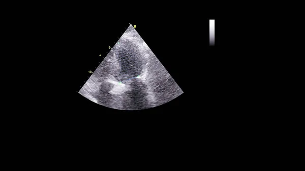 초음파 검사를 규모의 — 스톡 사진