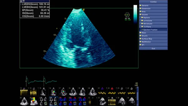 Gambar Jantung Selama Usg Transesophageal Dengan Mode Doppler — Stok Foto
