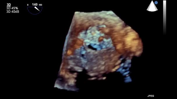 Echografie Transslokdarmonderzoek Van Het Hart — Stockvideo