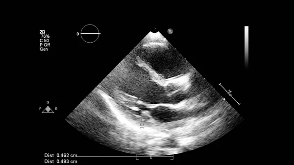 Изображение Сердца Сером Режиме Время Трансофагеального Ультразвука — стоковое фото