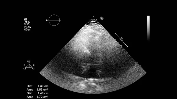 Transesofageal Ultrason Sırasında Kalbin Gri Ölçekli Görüntüsü — Stok fotoğraf