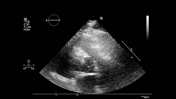 経食道超音波検査時のグレースケールモードで心臓の画像 — ストック写真