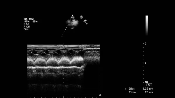 Kép Szív Szürke Skála Mód Során Transesophagealis Ultrahang — Stock Fotó