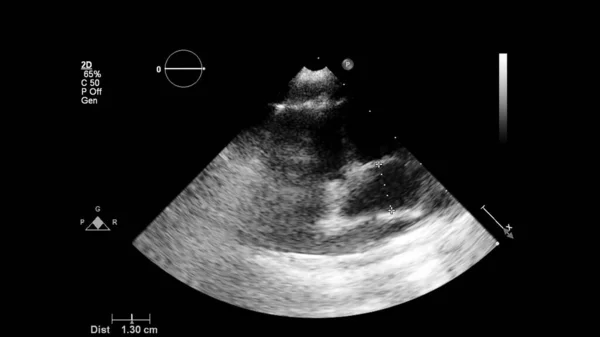 経食道超音波検査時のグレースケールモードで心臓の画像 — ストック写真