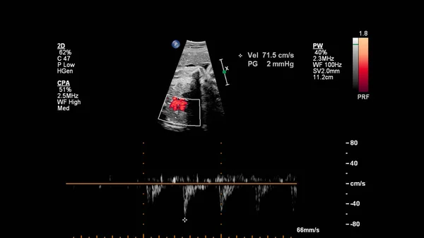 Ecografía Con Ecocardiografía Fetal —  Fotos de Stock