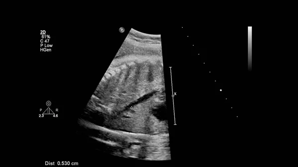 带胎儿超声心动图的超声屏幕 — 图库照片
