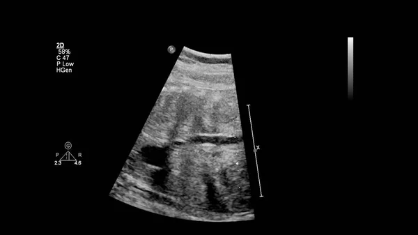 Echografie Scherm Met Foetale Echocardiografie — Stockfoto