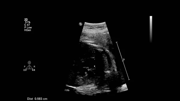 Echografie Scherm Met Foetale Echocardiografie — Stockfoto