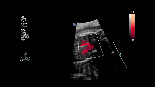 Echographie Avec Échocardiographie Foetale — Photo