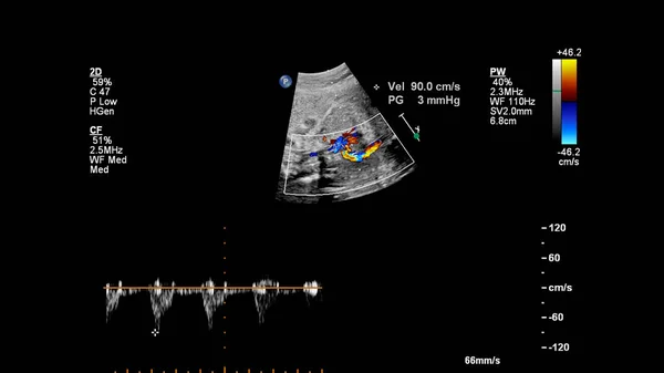 Echographie Avec Échocardiographie Foetale — Photo