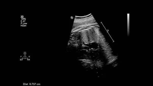 Ecran Ultrasunete Ecocardiografie Fetală — Fotografie, imagine de stoc
