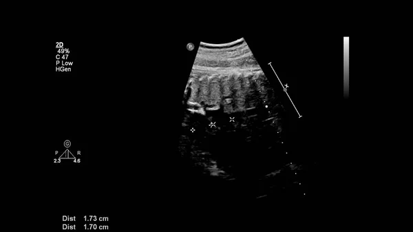 Ecrã Ultrassonográfico Com Ecocardiografia Fetal — Fotografia de Stock