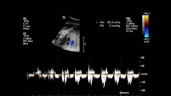 Ecografía Con Ecocardiografía Fetal —  Fotos de Stock