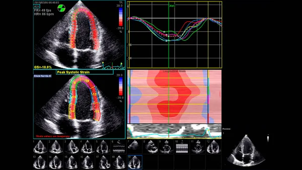 経食道超音波検査時のグレースケールモードで心臓の画像 ストック画像