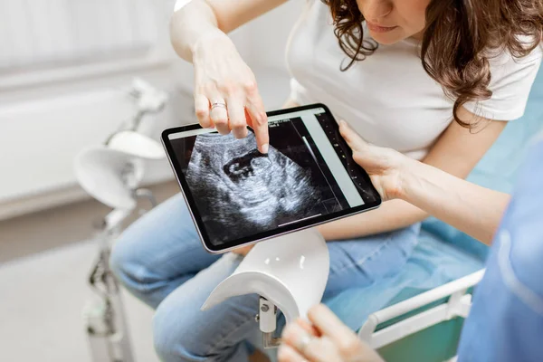 Медикаменты с ультразвуковым сканированием нерожденного ребенка во время обследования — стоковое фото