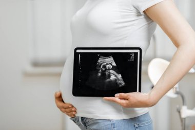 Bebeğinin ultrason taramasıyla hamile bir kadın.