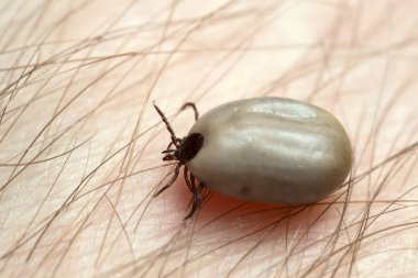 Castor fasulyesi kenesi, Ixodes ricinus, insan derisi üzerinde sürünen kan ve borrelioz gibi hastalıkların taşıyıcısı.