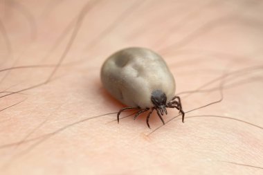 Castor fasulyesi kenesi, Ixodes ricinus, insan derisi üzerinde sürünen kan ve borrelioz gibi hastalıkların taşıyıcısı.