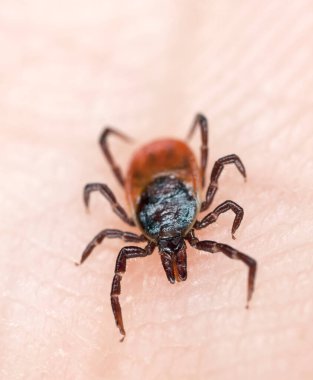 Castor fasülyesi kenesi, insan derisinde Ixodes ricinus, bu hayvan tüy ve borreliozis yayıcısıdır.