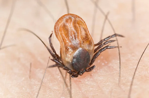 Carrapato Mamona Ixodes Ricinus Alimentando Humanos Este Animal Espalhador Tbe — Fotografia de Stock