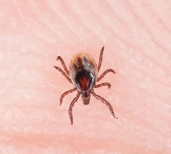 Castor Bean Tick Ixodes Ricinus Human Skin Animal Spreader Tbe — Stok Foto