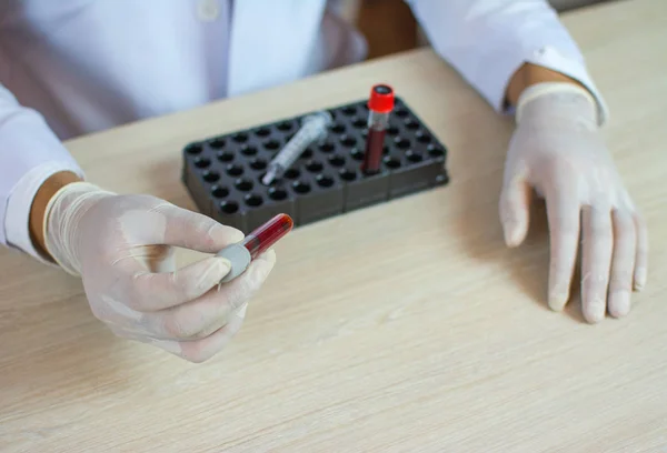 Lékař Zkumavka Krve Ruce Testování Laboratoři — Stock fotografie