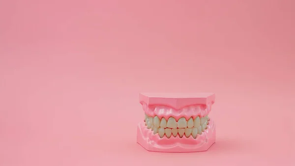 Dentures Pastelowym Różowym Tle Koncepcje Stomatologiczne — Zdjęcie stockowe