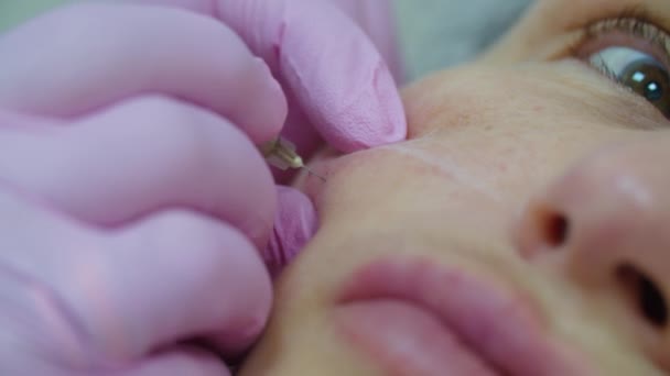 Kosmetolodzy wkładają różowe rękawiczki do wstrzykiwania leku przeciw starzeniu się twarzy dorosłej kobiecie za pomocą strzykawki, widok makro. Procedura wstrzyknięcia urody. — Wideo stockowe