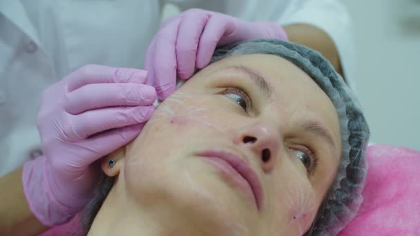 Cosmetologen overhandigen roze handschoenen die anti-aging gezichtsvuller injectie maken bij volwassen vrouw met spuit, macro view. Procedure voor schoonheidsinjectie. — Stockvideo