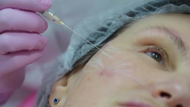Косметологи сдают розовые перчатки, делая инъекцию наполнителя для лица взрослой женщине со шприцем, с видом на макрос. процедура инъекции красоты . — стоковое видео