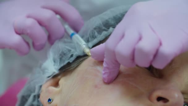 Cosmetologen overhandigen roze handschoenen die anti-aging gezichtsvuller injectie maken bij volwassen vrouw met spuit, macro view. Procedure voor schoonheidsinjectie. — Stockvideo