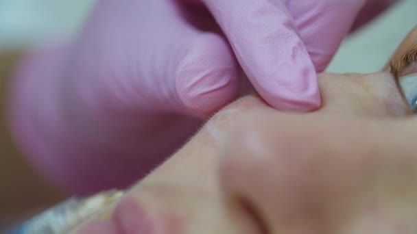 Los cosmetólogos entregan guantes rosados para hacer la inyección de relleno facial antienvejecimiento a la mujer adulta con jeringa, vista macro. Procedimiento de inyección de belleza . — Vídeo de stock