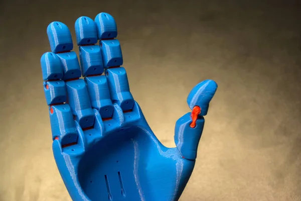 Mão Protética Azul Impressa — Fotografia de Stock