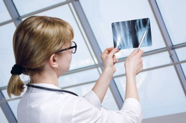 Genç bir doktor yan duran ve yaralanma büyük pencere arka plan incelenirken el x-ray görüntü işaret. Tıbbi hizmet ve tedavi kavramı.