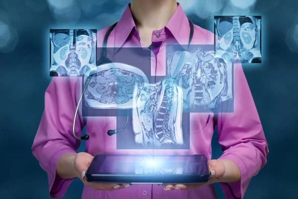 Ένας γιατρός που κρατά ένα δισκίο με ψηφιακά αποτελέσματα από εικόνες εσωτερικών οργάνων. — Φωτογραφία Αρχείου