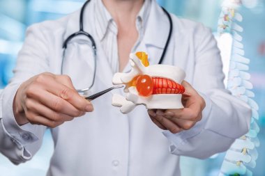 Cımbızla bel fıtığını gösteren bir doktor.