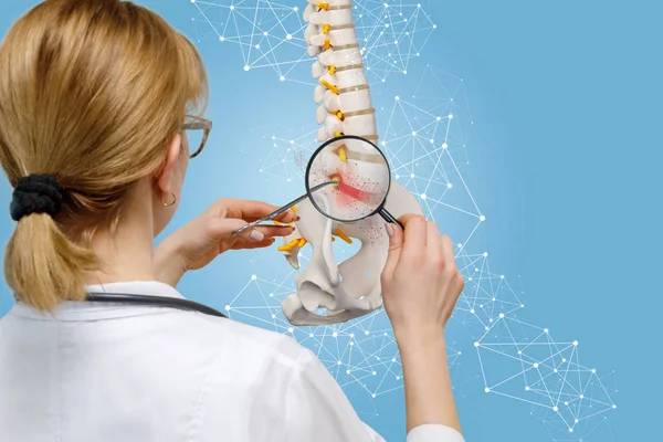 Il medico guarda attraverso una lente d'ingrandimento sull'ernia della colonna vertebrale  . — Foto Stock