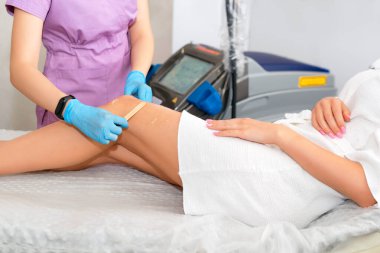 Güzellik kliniğindeki güzel kadın bacaklarında lazer epilasyonu. Saç aldırma kozmetoloji prosedürü. Lazer epilasyon ve kozmetoloji. Kozmetoloji ve Spa konsepti.