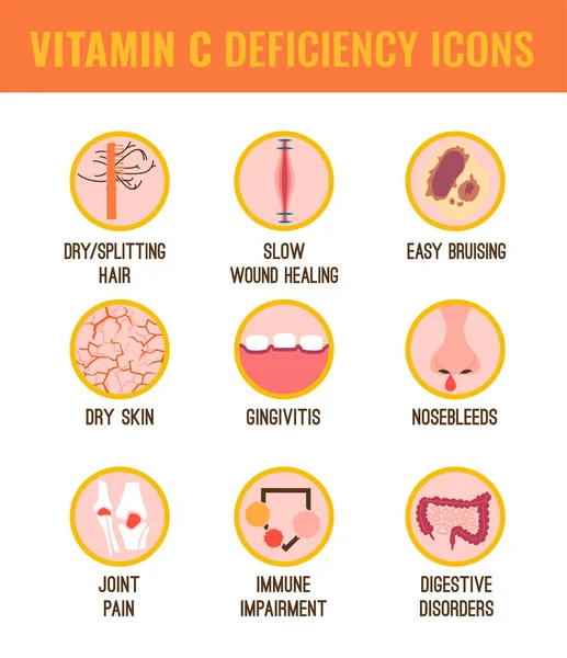 Vitamine C deficiëntie — Stockvector