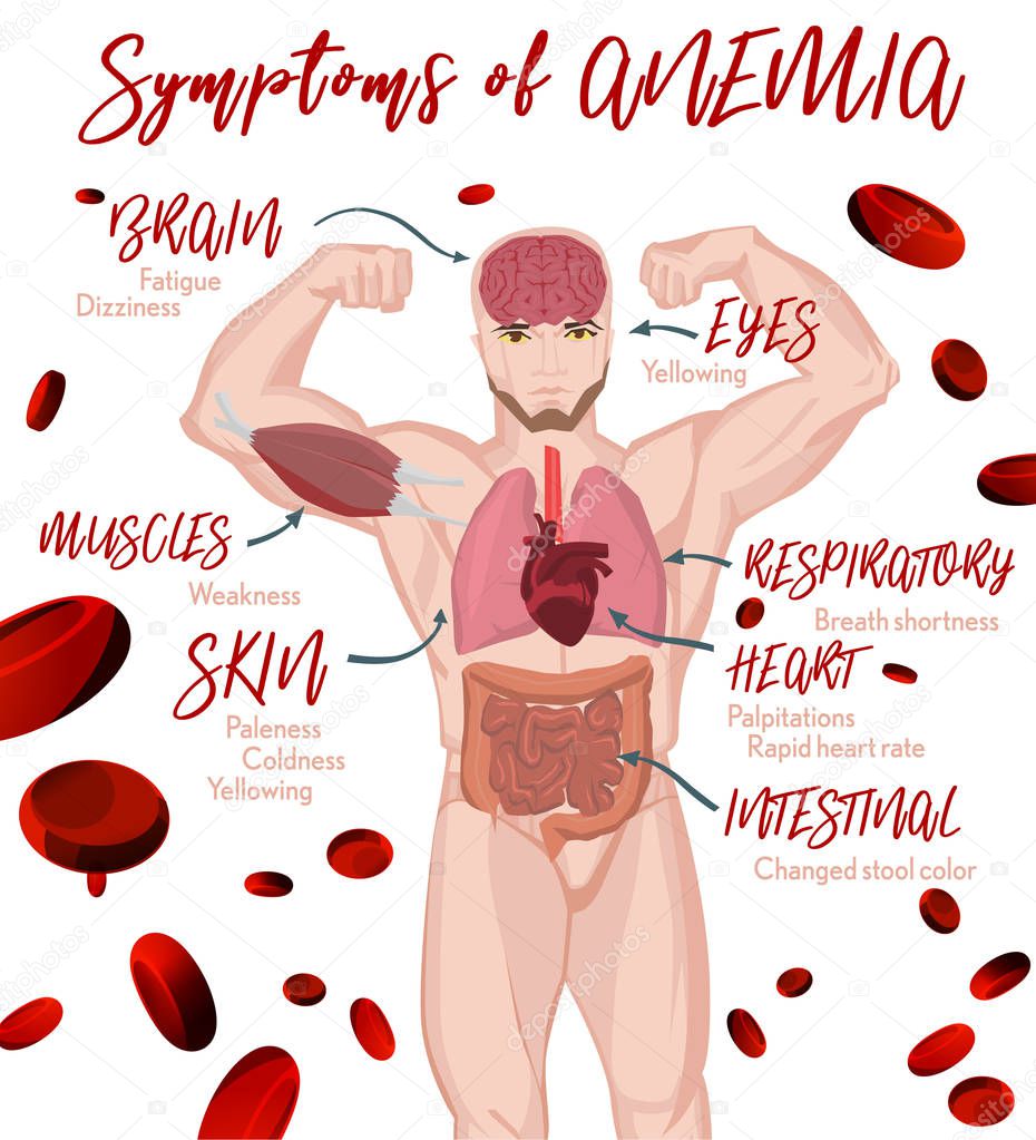 Anemia Symptoms Poster