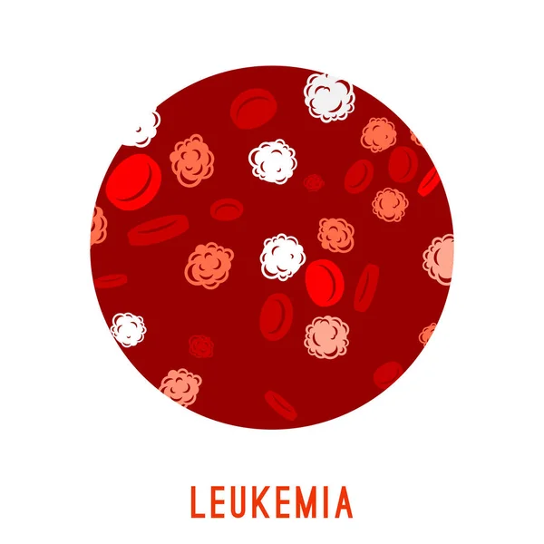 Leukemie bewustzijn afbeelding — Stockvector