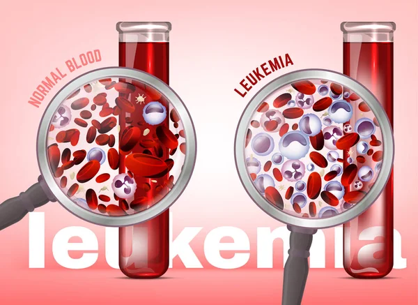 Leucemia fondo horizontal — Archivo Imágenes Vectoriales