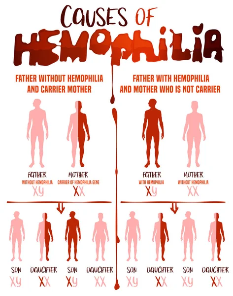 Hemofilie oorzaken Poster — Stockvector