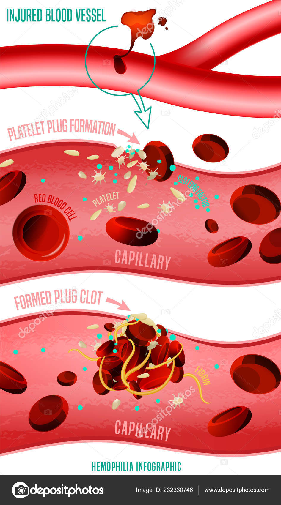 Blood clot formation Stock Vector Image by ©annyart #232330746