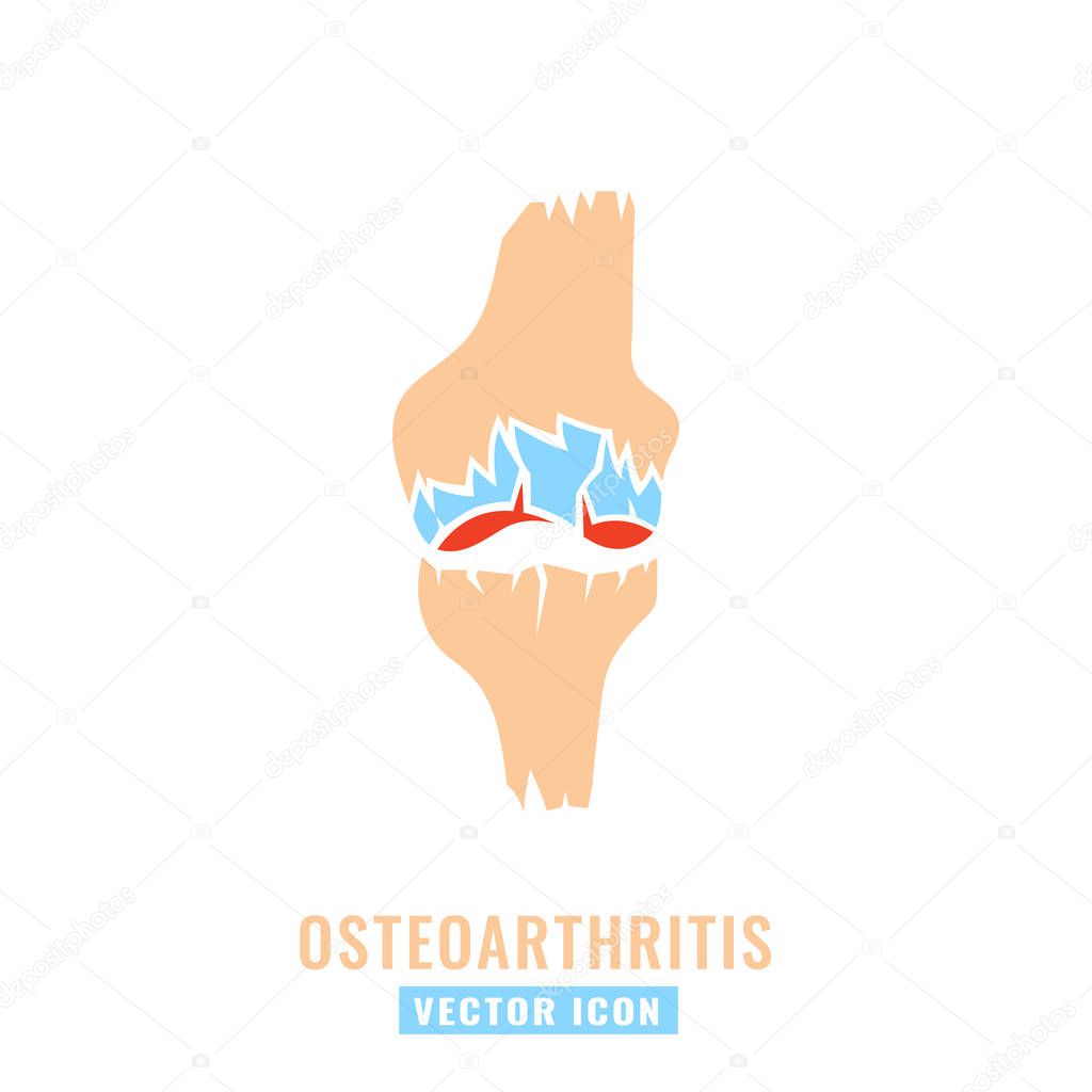 Osteoarthritis icon for medical design. Knee bones injury. Arthritis logotype in flat style. Leg pictogram. Rheumatism logo. Broken bone sign. Editable vector illustration isolated on white background