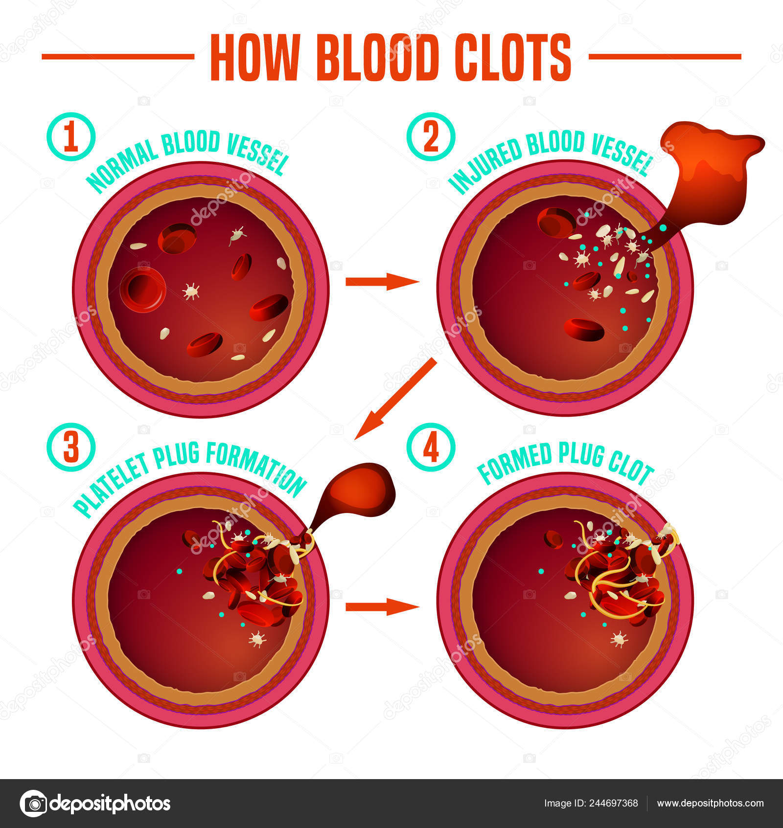Blood clotting process Stock Vector Image by ©annyart #244697368 Blood clotting process Stock Vector Image by ©annyart #244697368